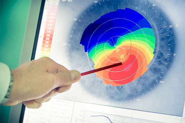 Eye exam monitoring and result at LaCroix Eye Care