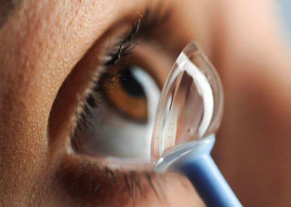 Close up of specialty scleral lenses